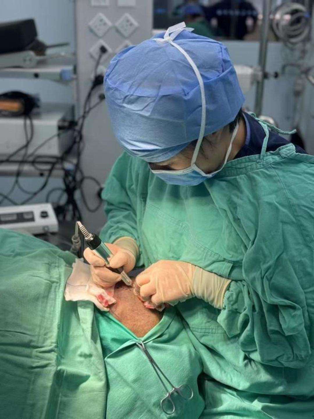 北京朝阳医院整形外科_瘢痕性脱发毛发移植_毛发种植哪里效果最好