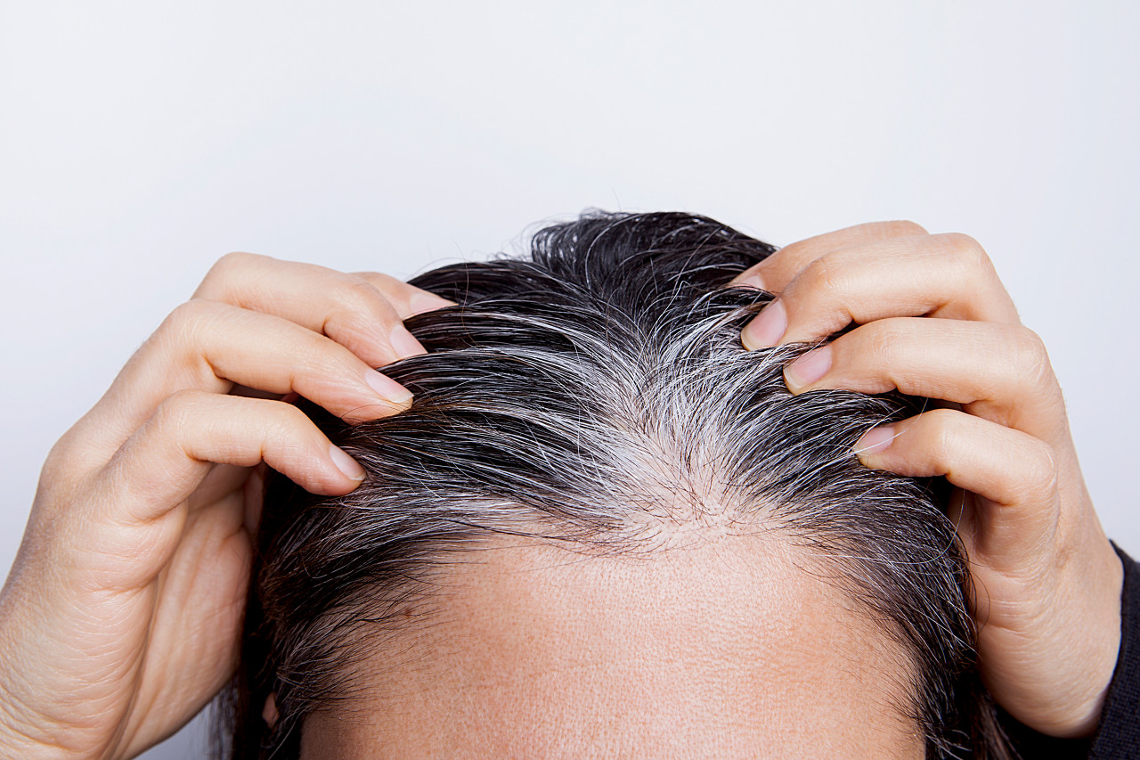 精神压力白发_黑素干细胞消耗_斑秃长一截变白又断掉是什么原因