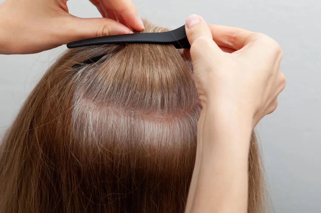 精神压力白发_熬夜白发_斑秃长一截变白又断掉是什么原因