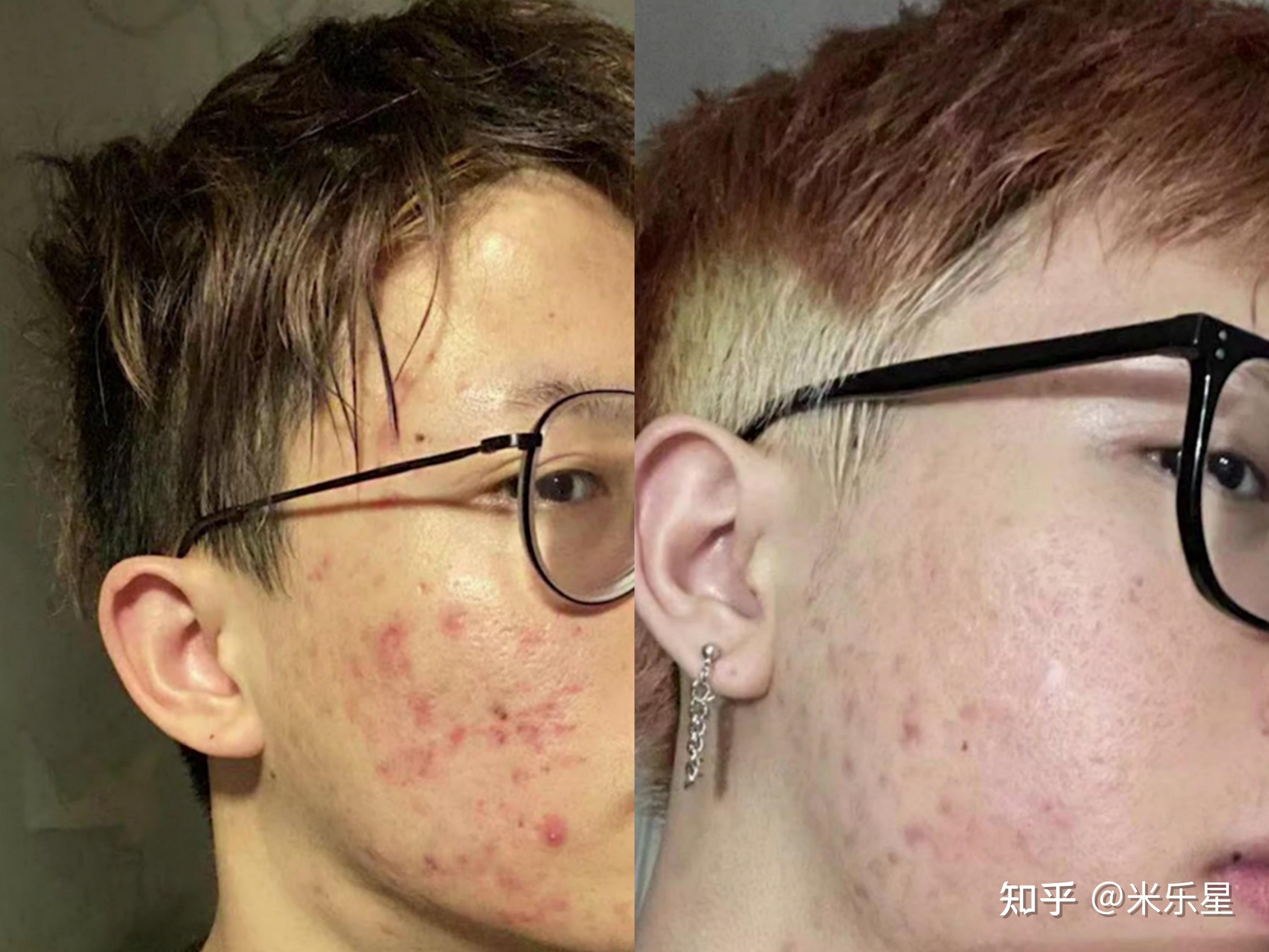 男生冬季穿什么贴身衣服_普通男生28天改造秘籍 颜值气质快速翻10倍 精致同时更有男人味