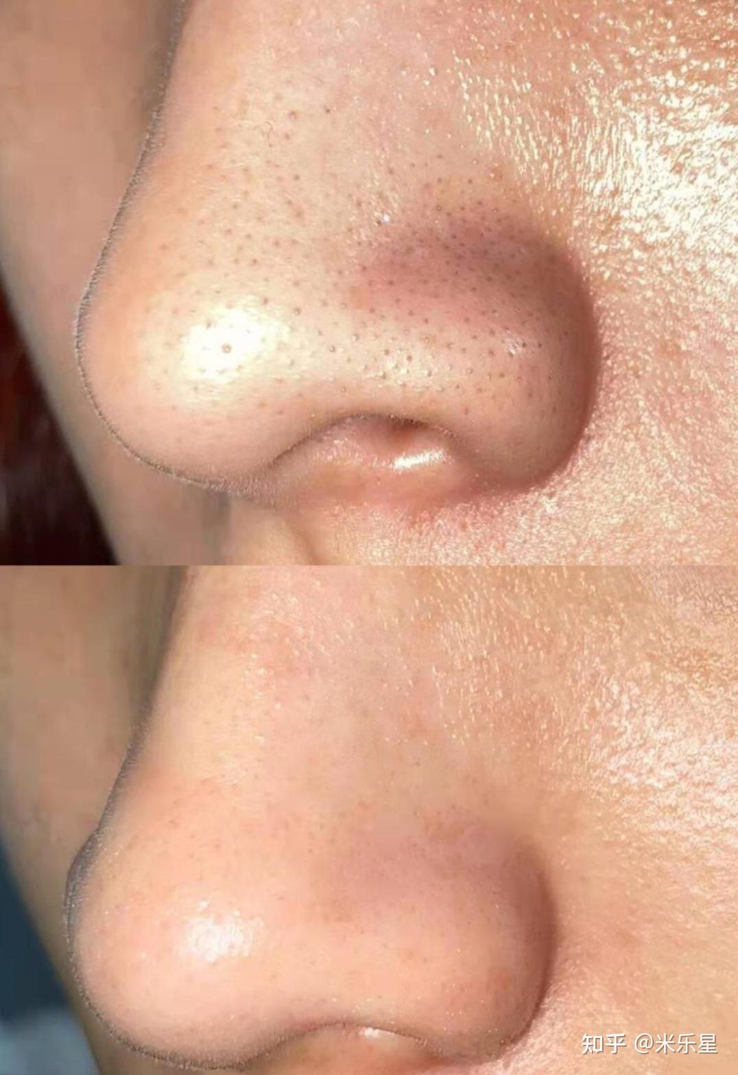 普通男生28天改造秘籍 颜值气质快速翻10倍 精致同时更有男人味_男生冬季穿什么贴身衣服