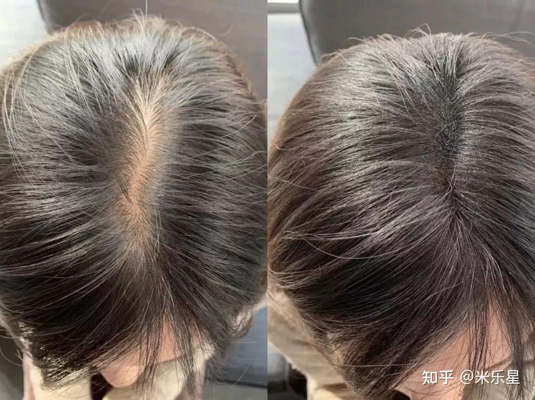 普通男生28天改造秘籍 颜值气质快速翻10倍 精致同时更有男人味_男生冬季穿什么贴身衣服