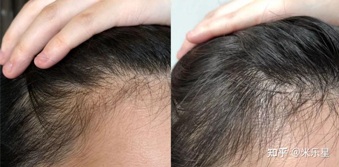 普通男生28天改造秘籍 颜值气质快速翻10倍 精致同时更有男人味_男生冬季穿什么贴身衣服