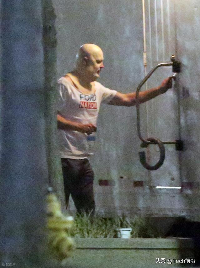 长期戴假发危害_头发留长有什么危害_假发头皮损伤