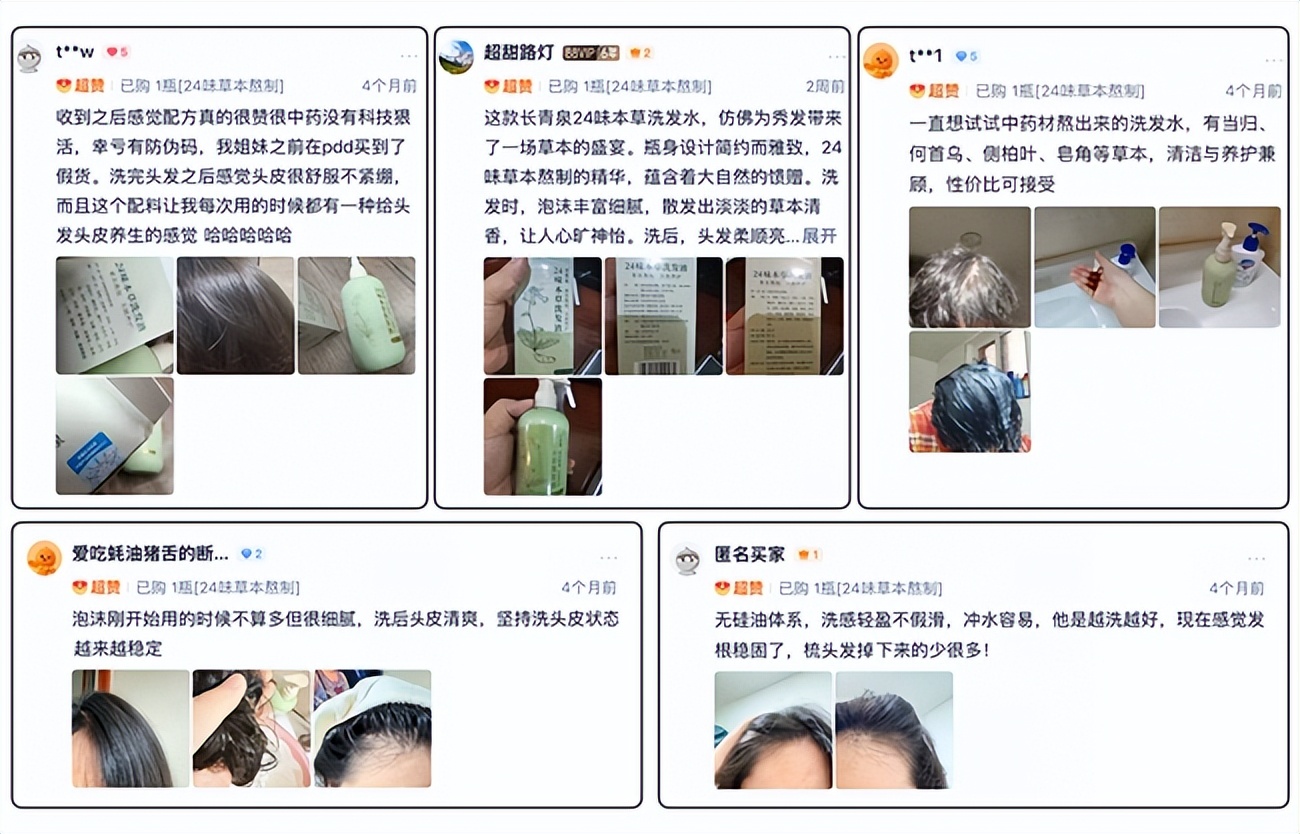 油性头皮脱发核心成因_市面防脱产品常见弊端_女性两侧头发稀少原因