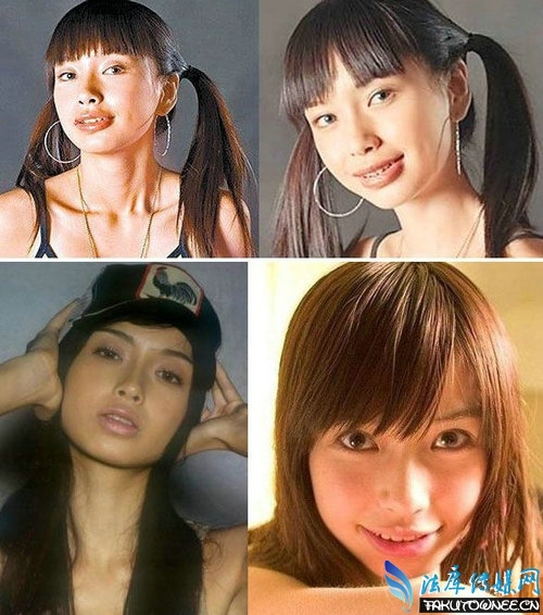 Angelababy牙套时期雷人照片是怎么回事?明星整牙前后对比照片