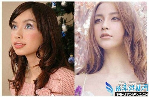 Angelababy牙套时期雷人照片是怎么回事?明星整牙前后对比照片