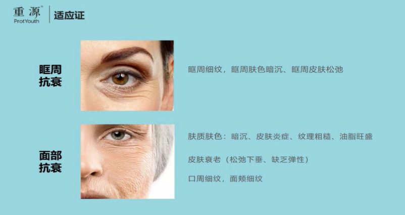 眼袋形成原因_假性眼袋如何消除_泡沫去眼袋是真的假的